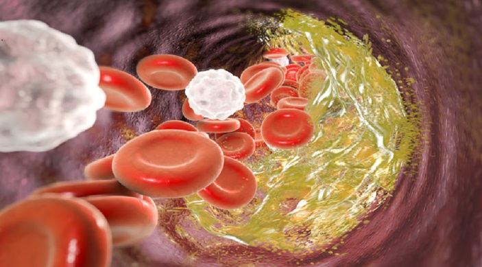 تحذير خطير.. متخصص يكشف كيف يدمّر “الكوليسترول” جسدك بصمت