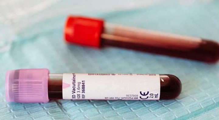  تصل للوفاة.. اختلاف نتائج اختبارات وظائف الكلى يُنذر بمخاطر صحية