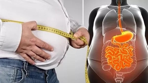استشاري أمراض القلب: خسارة 5% من الوزن تقلل الدهون الحشوية 4 أضعاف